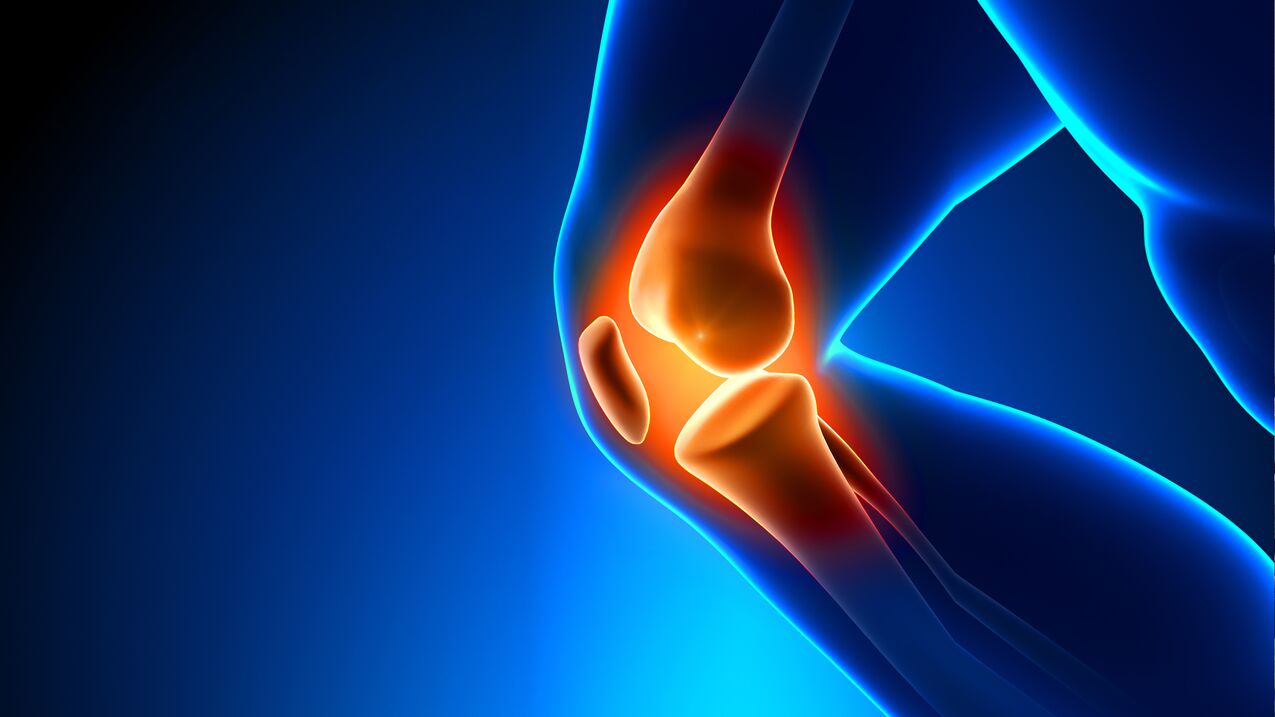 joint arthrosis